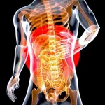 Both Heart Attacks and Inflammatory Bowel Disease (IBD) are a Concern